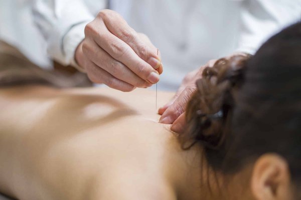 Quels sont les bienfaits de l'acupuncture pour la perte de poids ?